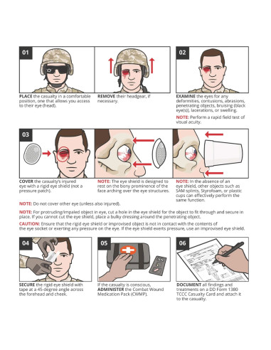 PROTECTION OCULAIRE EYE SHIELD